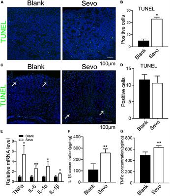 Sevoflurane exposure induces neurotoxicity by regulating mitochondrial function of microglia due to NAD insufficiency
